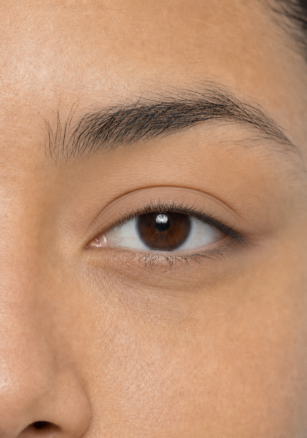 Visible crease eyelid reference
